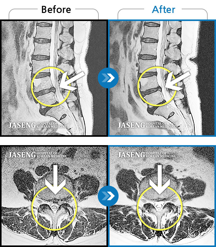 ڻѹ溴 ġ MRI  ġ-ɾִٰ Ͼ  㸮  鼭  Ŀ.