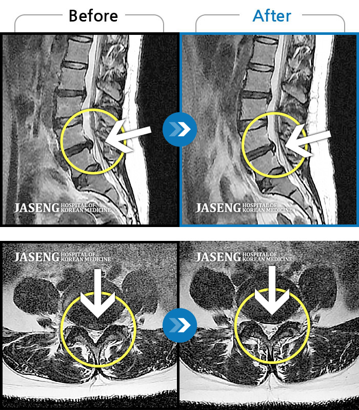 ϻڻѹ溴 ġ MRI  ġ-ó    ݿ  ,      ؼ ŵ  ¿ϴ.