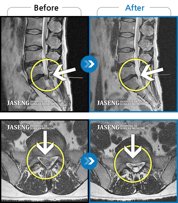 дڻѹ溴 ġ MRI  ġ- ݺ ٸ  ߹ٴڱ    ȱ 㸮 Ⱑ  