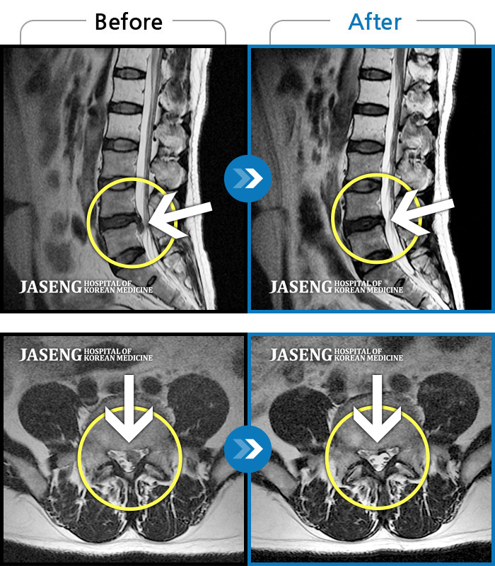 ڻѹ溴 ġ MRI  ġ-㸮,  ٸ ٱ  ־ 縻 ű⵵ . 