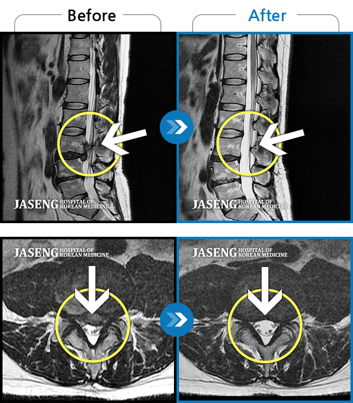 ؿڻѹ溴 ġ MRI  ġ- 㸮,     ٸ  ؽ