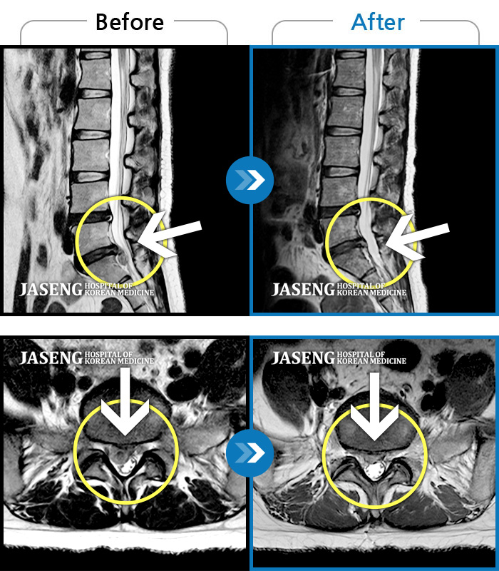 ڻѹ溴 ġ MRI  ġ- 㸮   ϰ ٸ  㸮 ȹٷ  . 