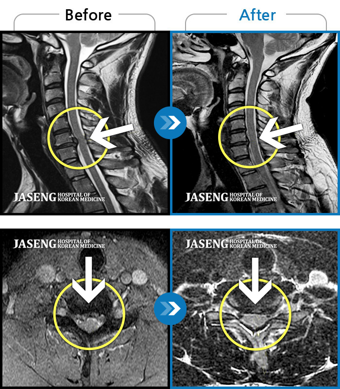 ڻѹ溴 ġ MRI  ġ- İ    