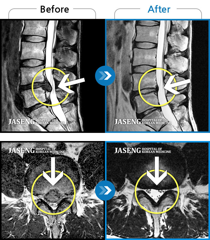 ؿڻѹ溴 ġ MRI  ġ- 㸮     Ʒ  ̾.