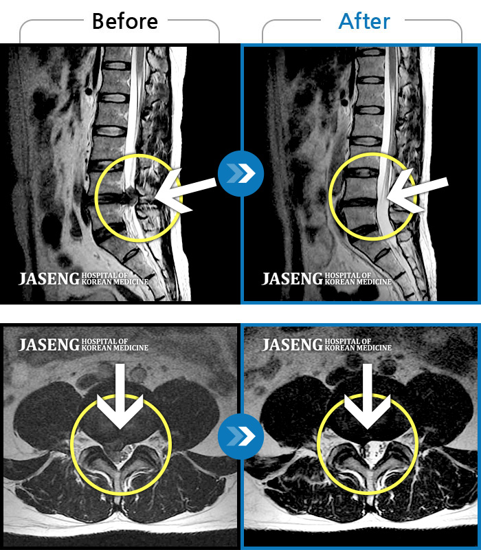 ڻѹ溴 ġ MRI  ġ- ٸ ߳ .