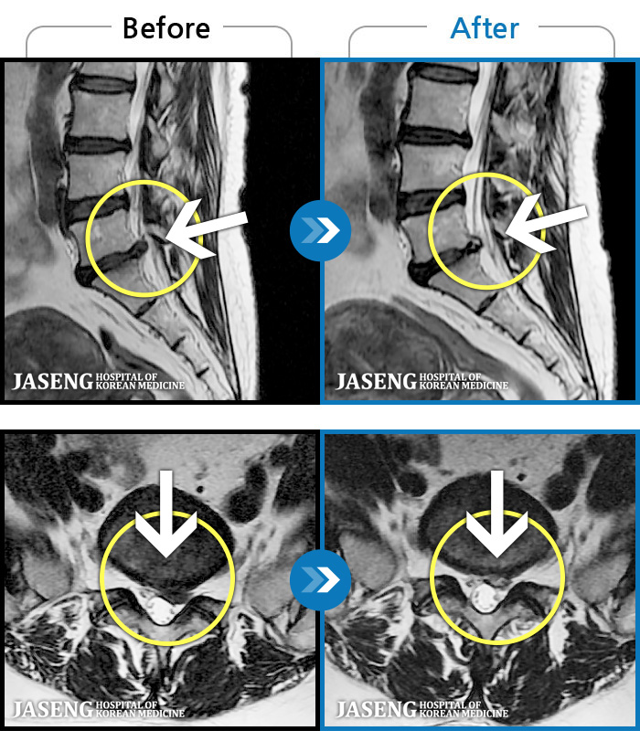 ڻѹ溴 ġ MRI  ġ-㸮   ְ ٸ   ȱⰡ .