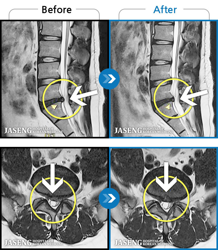 �����ڻ��ѹ溴�� ġ���� MRI�� ���� ġ����-���� �㸮 ������ ���� ��������� ���ݵǴ� �������� �ְ�, �ɰų� ���� �� ���� ��ȭ�Ǿ� �����ϼ̽��ϴ�.