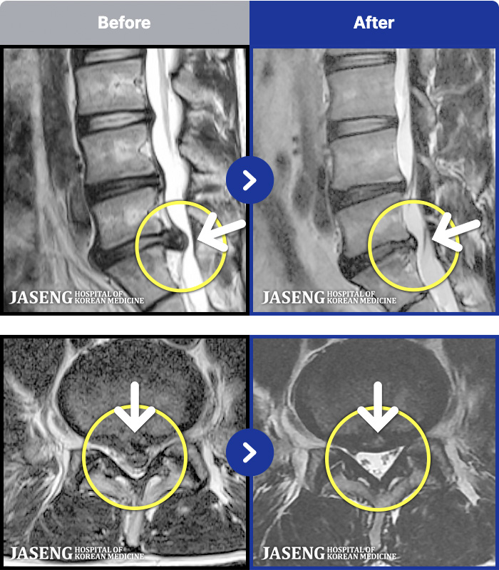 �����ڻ��ѹ溴�� ġ���� MRI�� ���� ġ����-���� �㸮 ������ ���� ����� ���� 