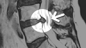 MRI  1